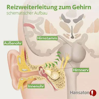 reizweiterleitung-zum-gehirn-400x400.webp