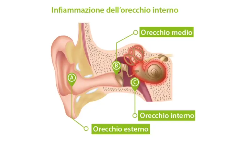 822x496_infiammazione_dell_orecchio_interno.webp