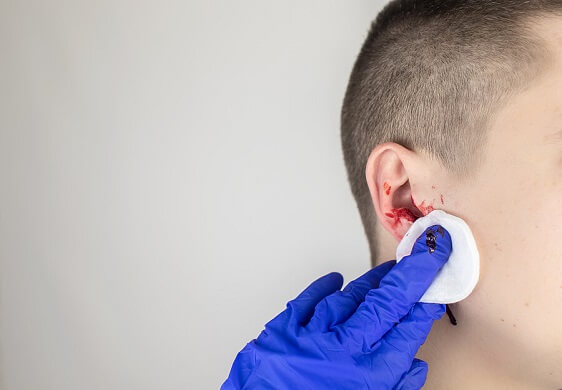 man-ear-bleeding-mobile-banner.jpg