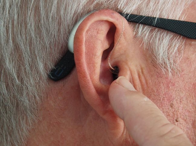 contour-d-oreille.jpg