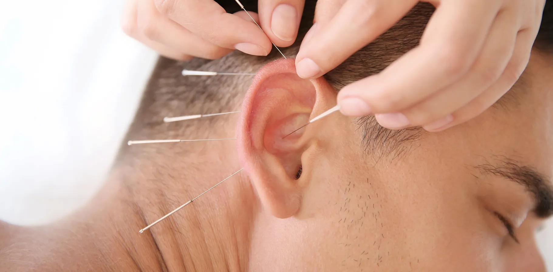 HH_ear-acupuncture_DESKTOP.jpg