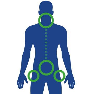 Prizadeti deli telesa