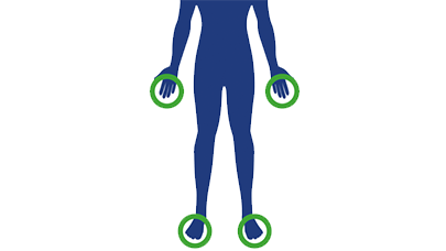 Prizadeti deli telesa