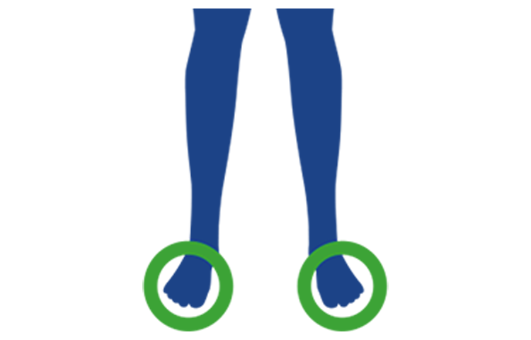 Prizadeti deli telesa