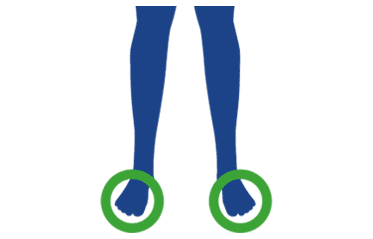 Prizadeti deli telesa Prizadeti deli telesa