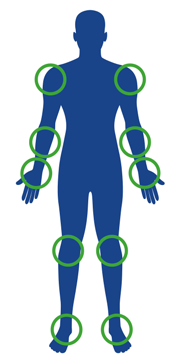 Prizadeti deli telesa