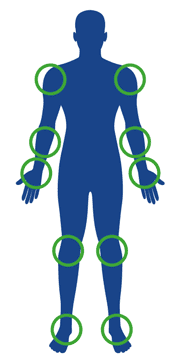 Prizadeti deli telesa Prizadeti deli telesa