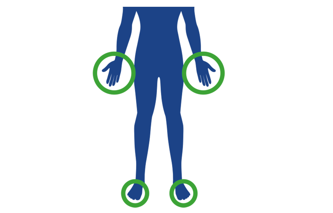 Prizadeti deli telesa