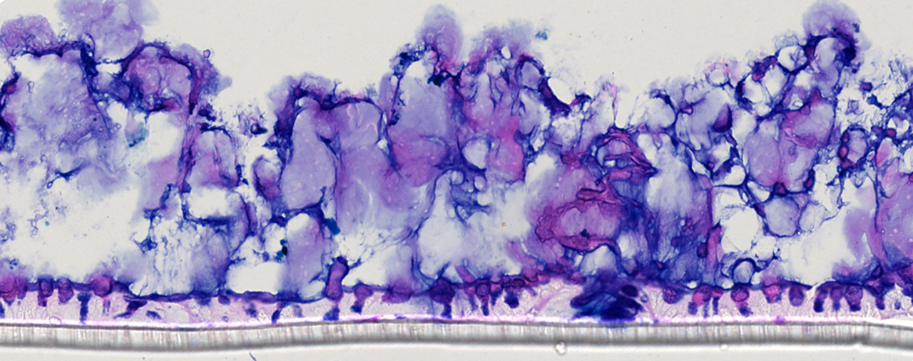 καλλιέργεια_κολονικών_επιθηλιακών_κυττάρων