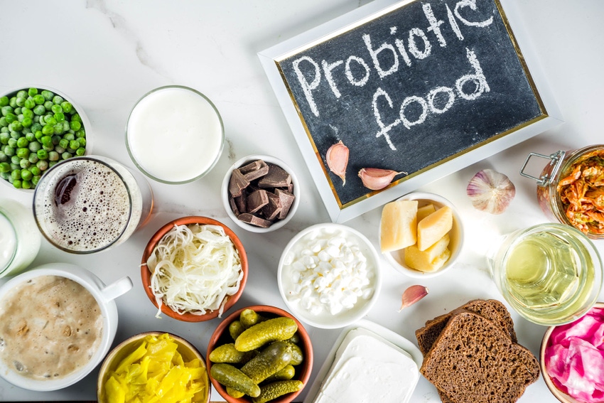 A variety of probiotic foods A variety of probiotic foods