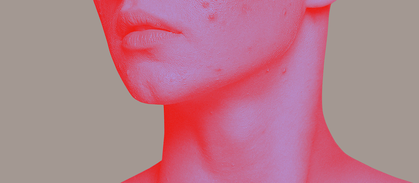 Krooninen lymfaattinen leukemia (KLL)