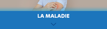 bloc_la_maladie_open.png
