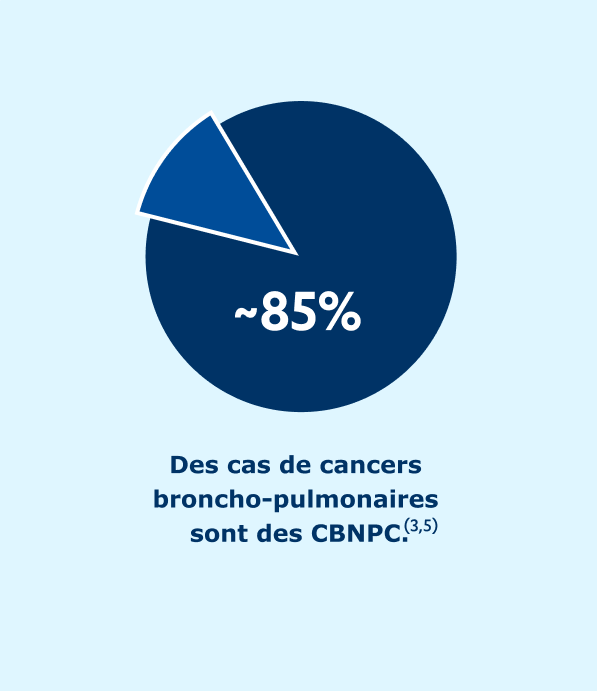 schema_cancer_bronchique