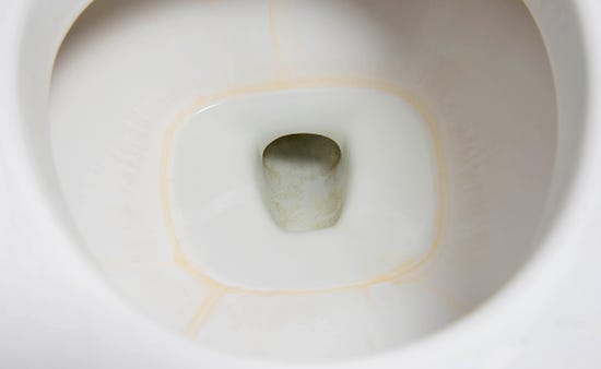How to get rid of toilet rim limescale?