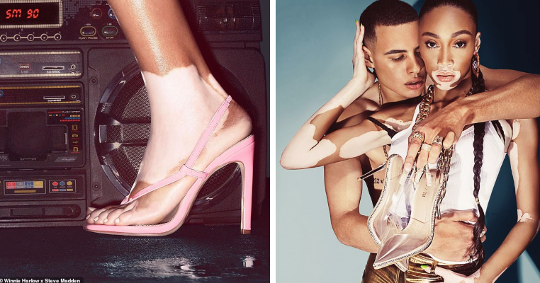 Winnie Harlow Steve Madden Step into Shoe Partnership License Global