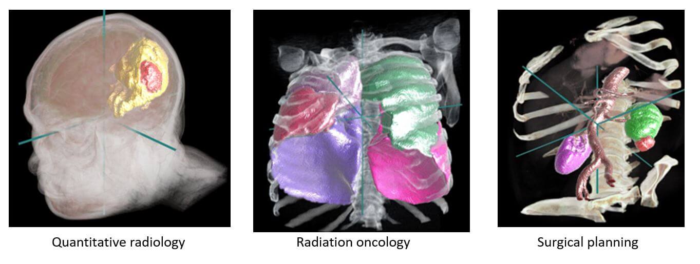 Radiology results figures illustration
