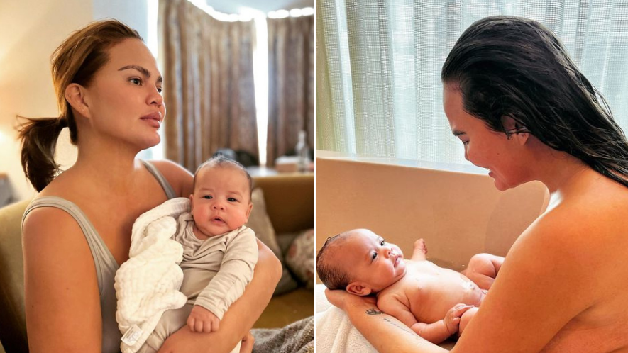 Breastfeeding mum Chrissy Teigen's freaking out about her veiny