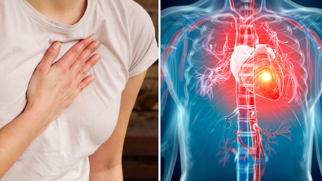 Heart attack symptoms you could experience one month before it actually happens