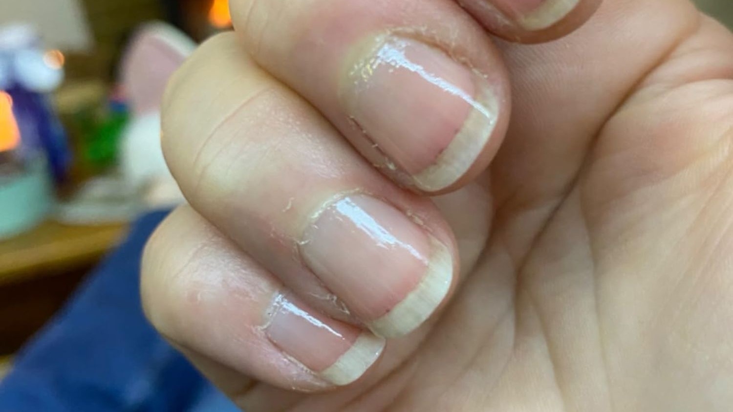 A woman has credited magnesium with helping her grow her nails (Amazon reviews)