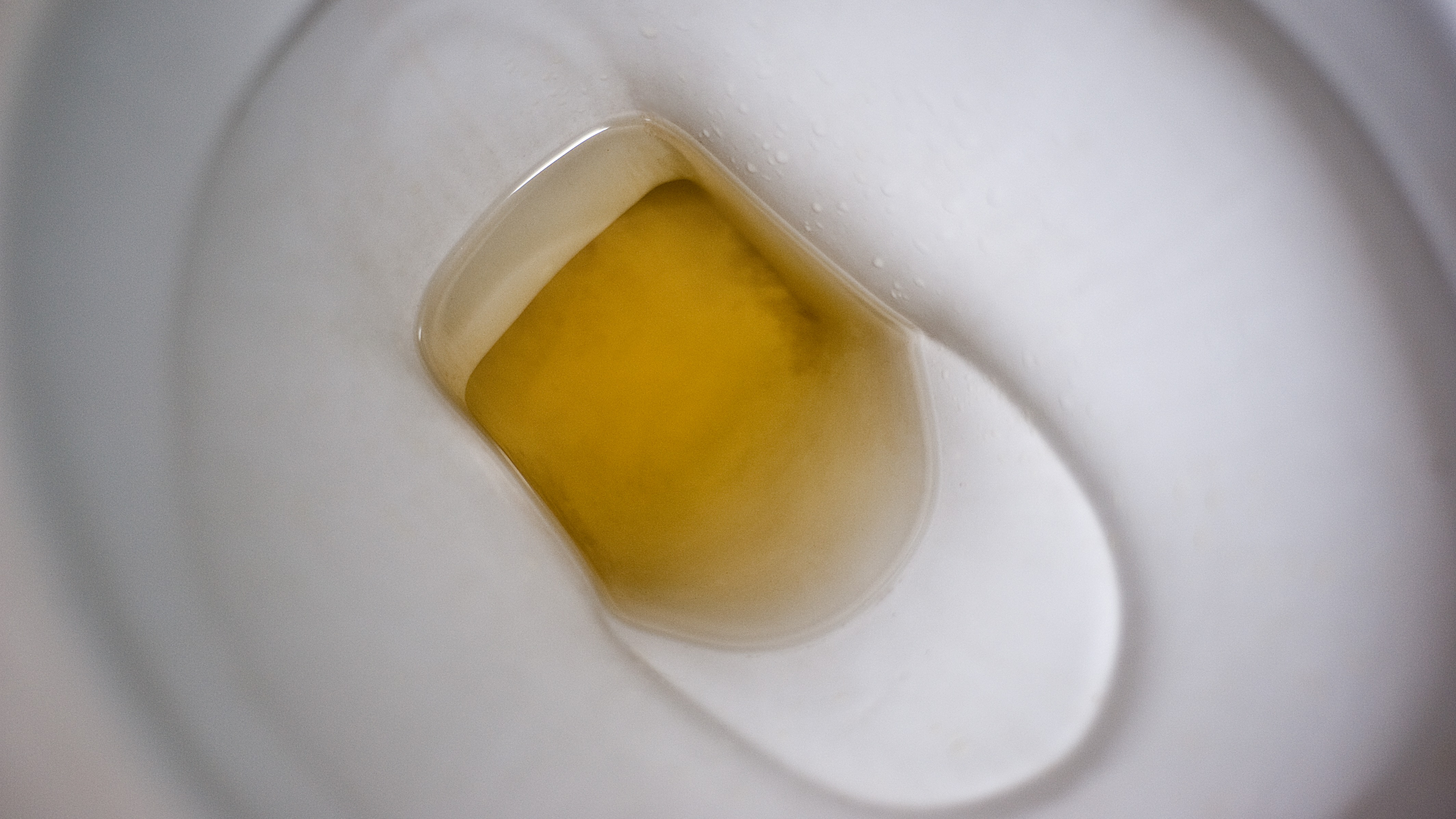 does tirzepatide make your pee smell Warning issued to anyone whose pee smells 'fruity'