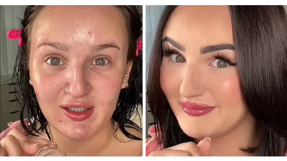 Tomhed Teenageår Fantasifulde Make-up artist praised for how perfectly she covers up acne