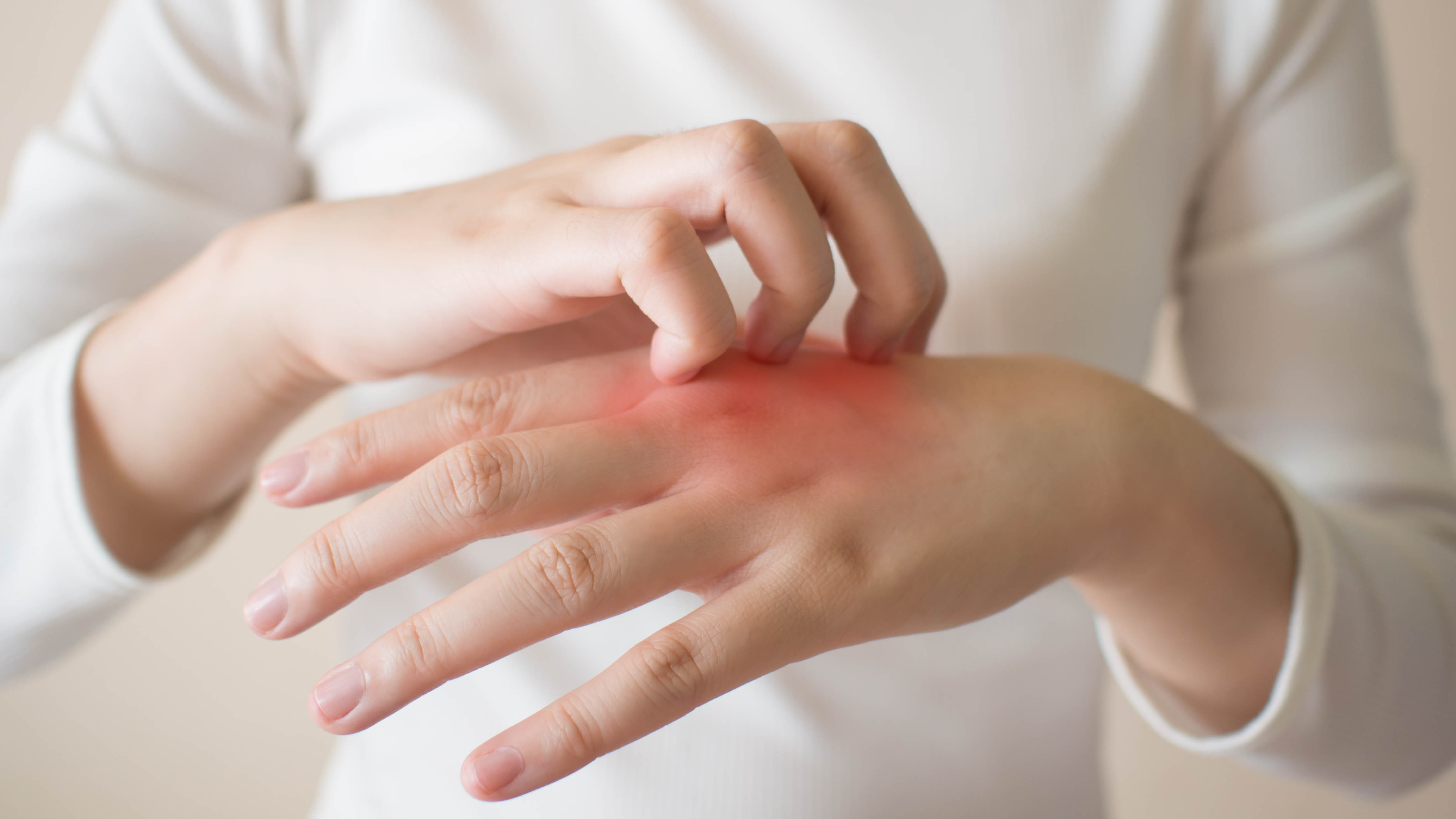Rash Could Be A Little-Known Omicron Symptom, Expert Warns - Vimarsana News