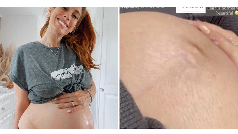 Hairy Pregnant Wife