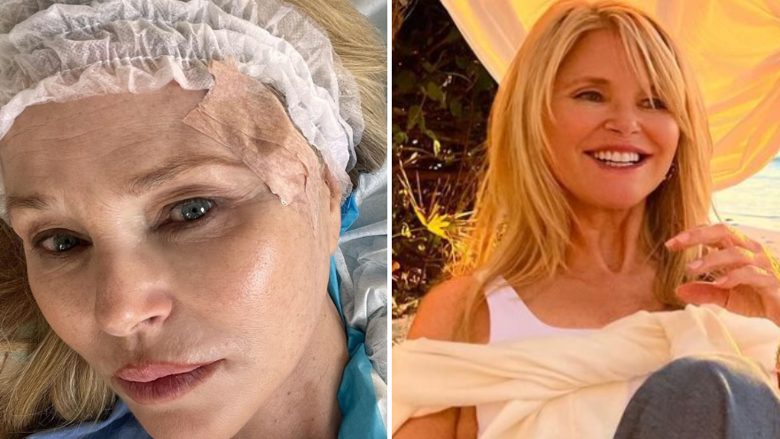 At 70, Christie Brinkley Reveals Serious Health Diagnosis in Raw Post