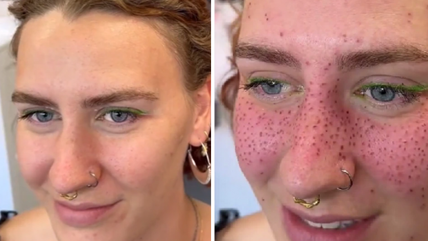 VIDEO Permanent FRECKLE Beauty FAIL Goes VIRAL