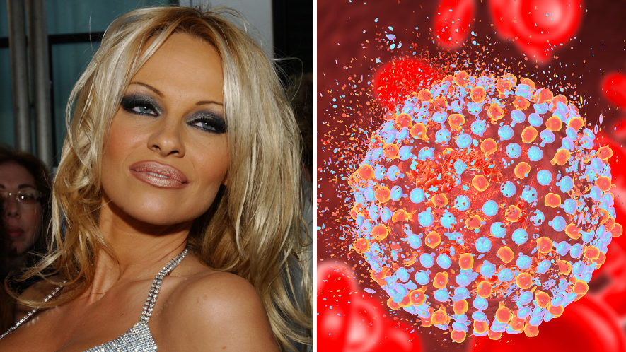 Eight signs of Hepatitis C as Pamela Anderson revealed she was given just 10 years to live