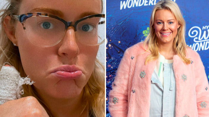 Love Island star rushed to hospital after nasty accident - Vimarsana News