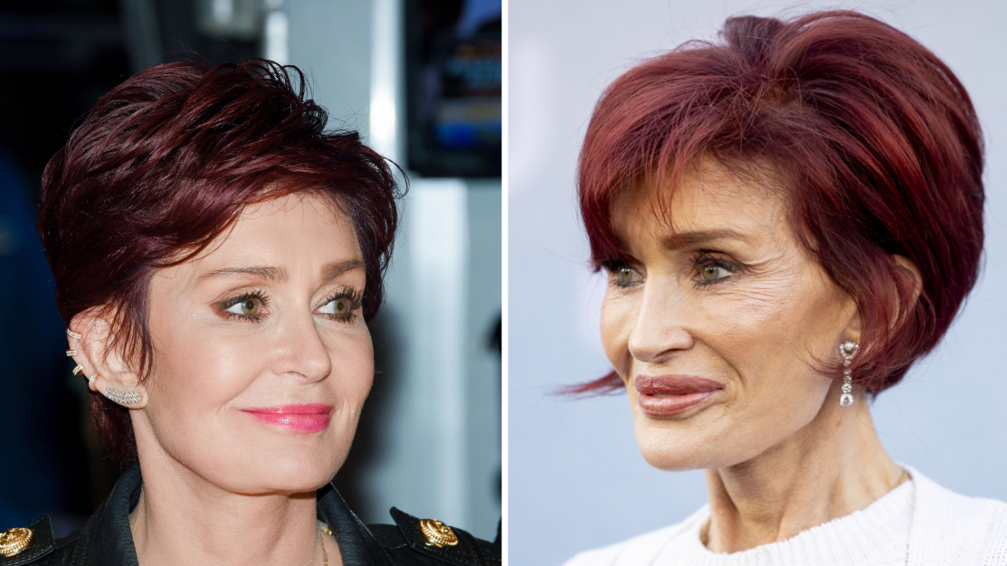 sharon osbourne semaglutide reveals sickening side effects of Ozempic Sharon Osbourne & Ozempic #ozempic