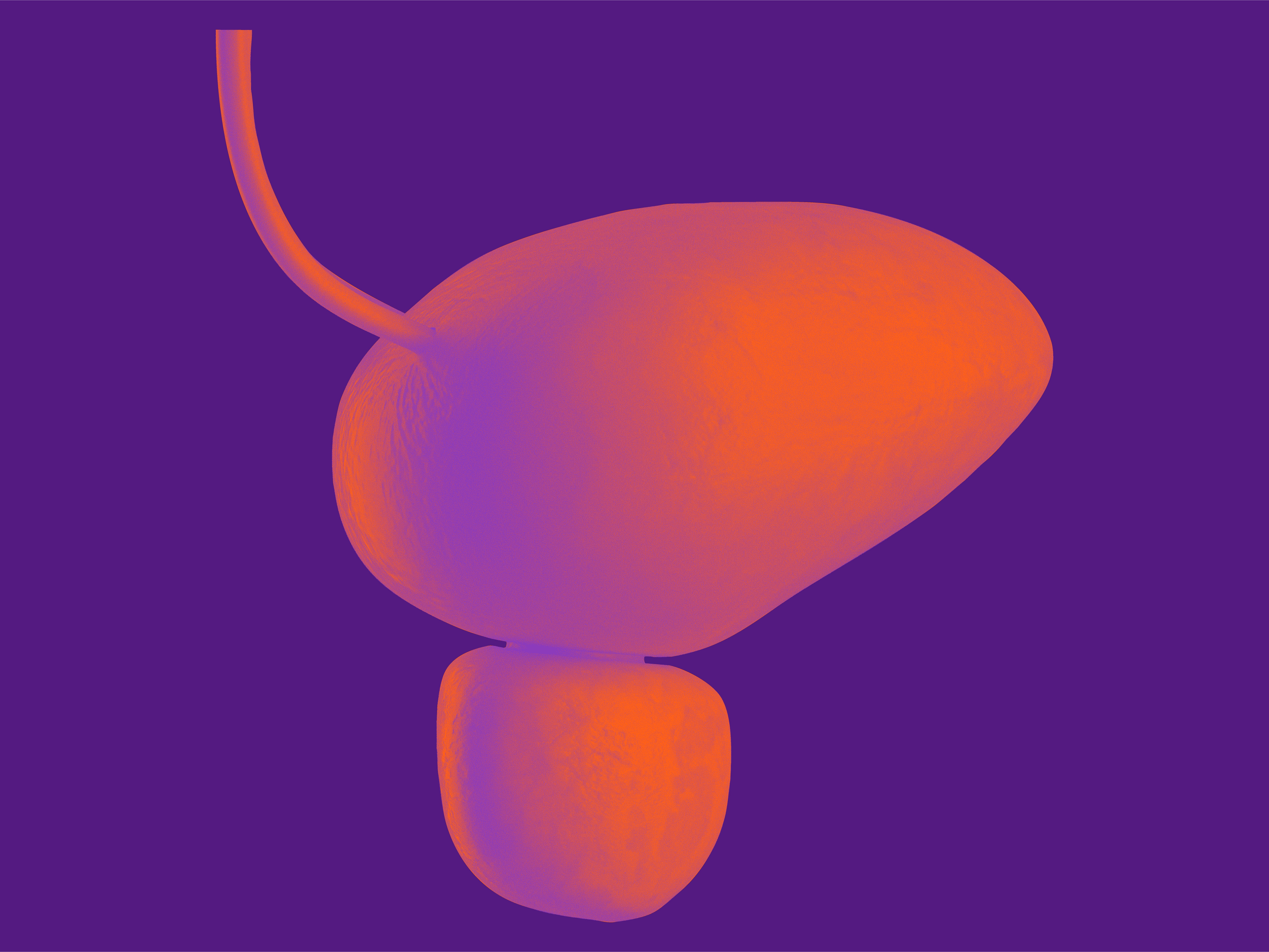 Fokusgebiet: Onkologie & Hämatologie - Blasenkrebs