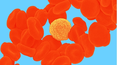 Fokusgebiet: Onkologie & Hämatologie