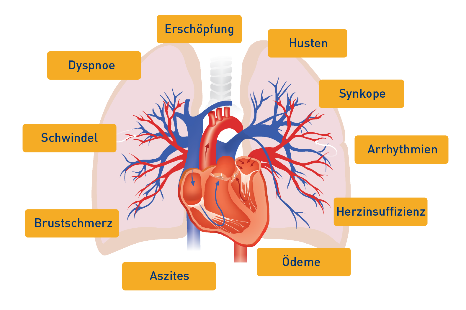 Typische Symptome der PAH
