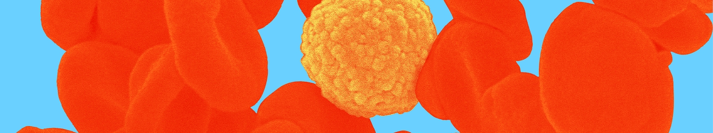 Onkologie & Hämatologie