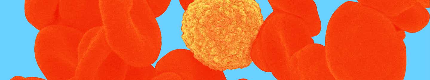 Onkologie & Hämatologie