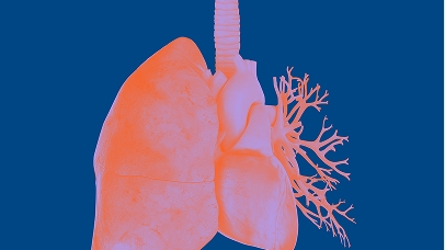 Fokusgebiet: Kardio-Pulmologie