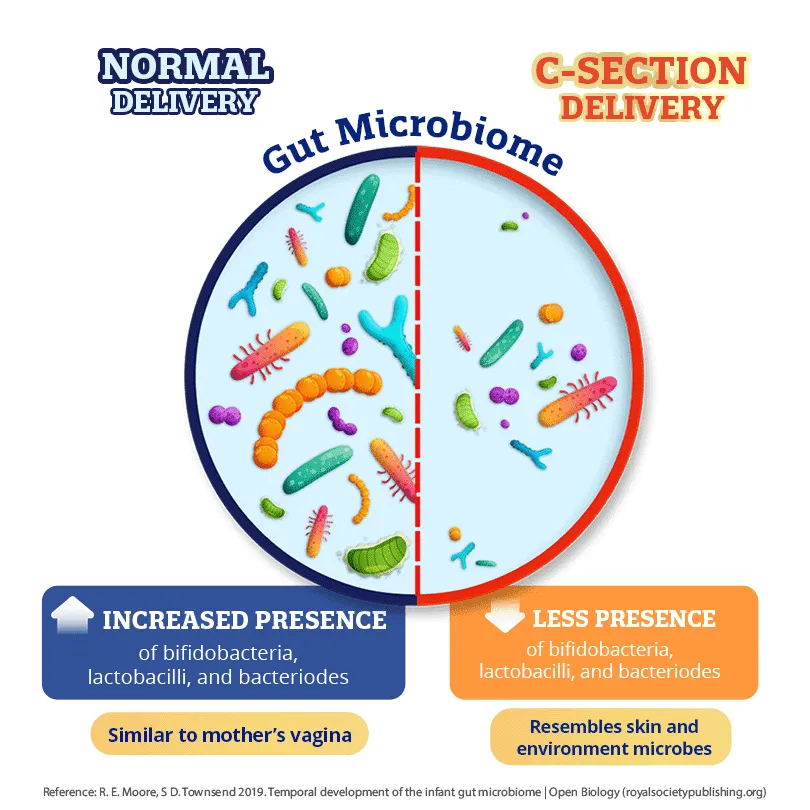 Diagram comparing gut microbiome differences between normal delivery and C-section delivery