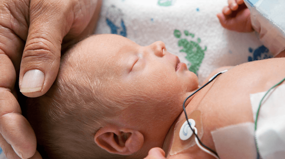 World Prematurity Day 2021