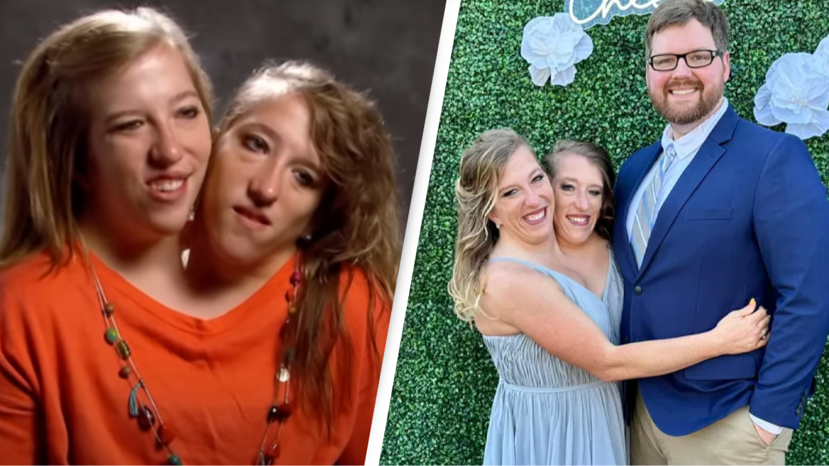 Conjoined twins Abby and Brittany Hensel answer all the questions everyone  regularly asks them