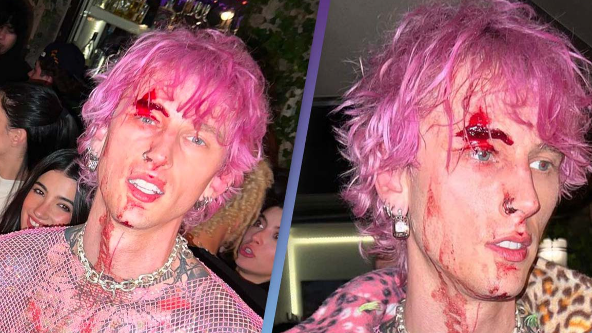 Machine Gun Kelly dyes his hair pink: Pics