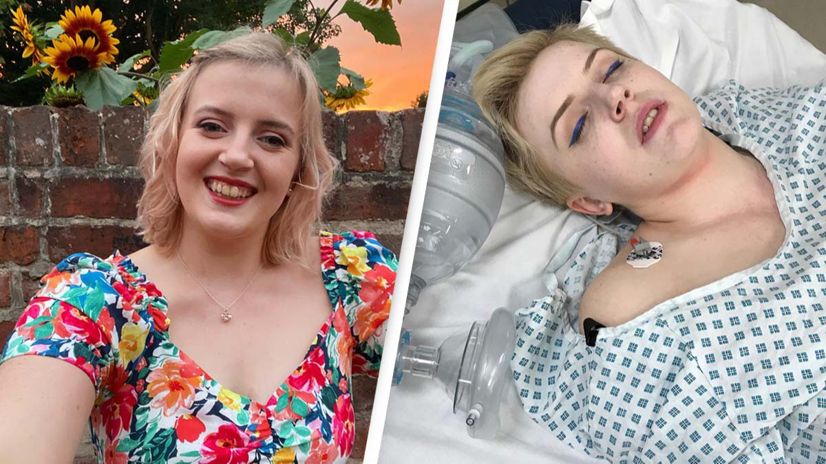Woman Allergic To Strong Emotions Nearly Died From Laughing Too Much - Vimarsana News