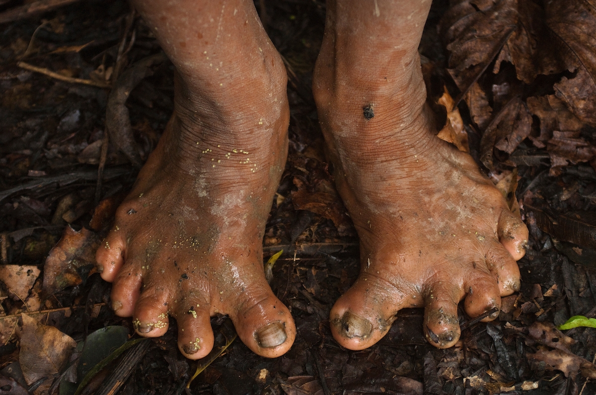 Indigenous people who climb trees regularly to survive have seen major  changes to their feet