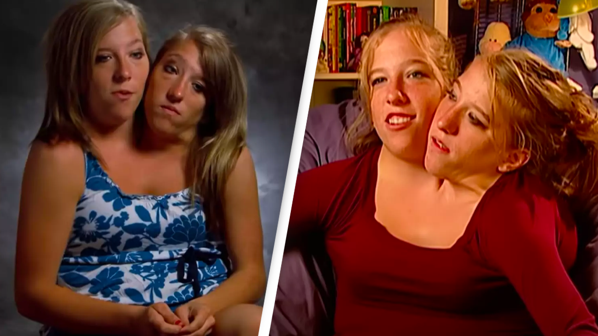 Conjoined twins Abby and Brittany Hensel explain how they drive a car