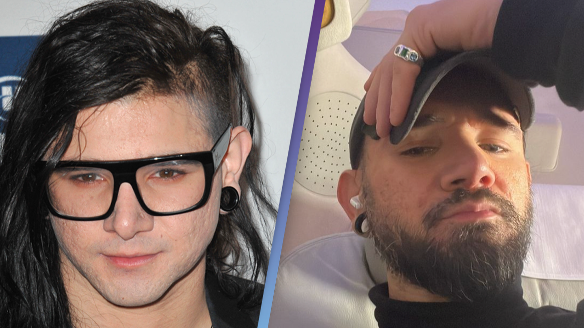 Skrillex shows off dramatic new look and fans are stunned