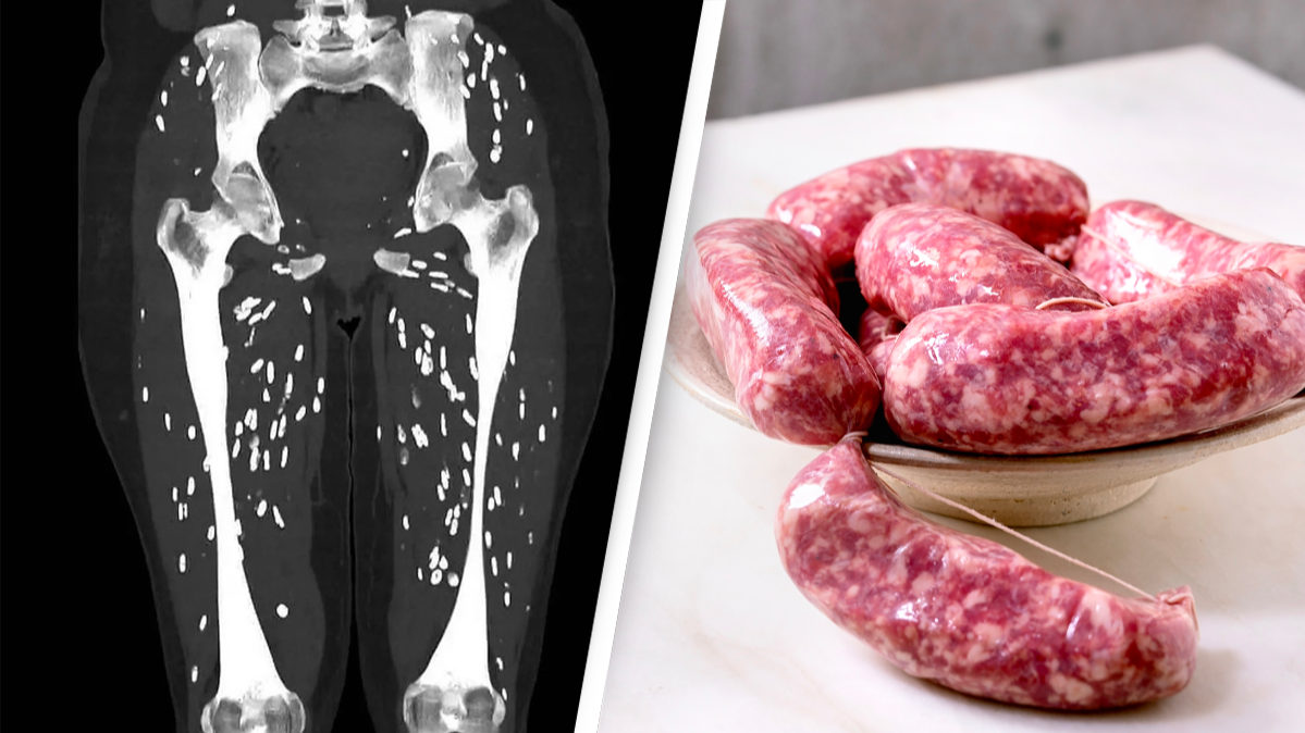 Traumatizing scan shows the horrifying effect of undercooking pork ...