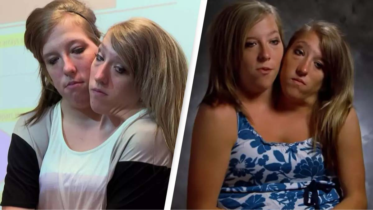 Conjoined Twin Sisters Explain How They Drive A Car - LADbible