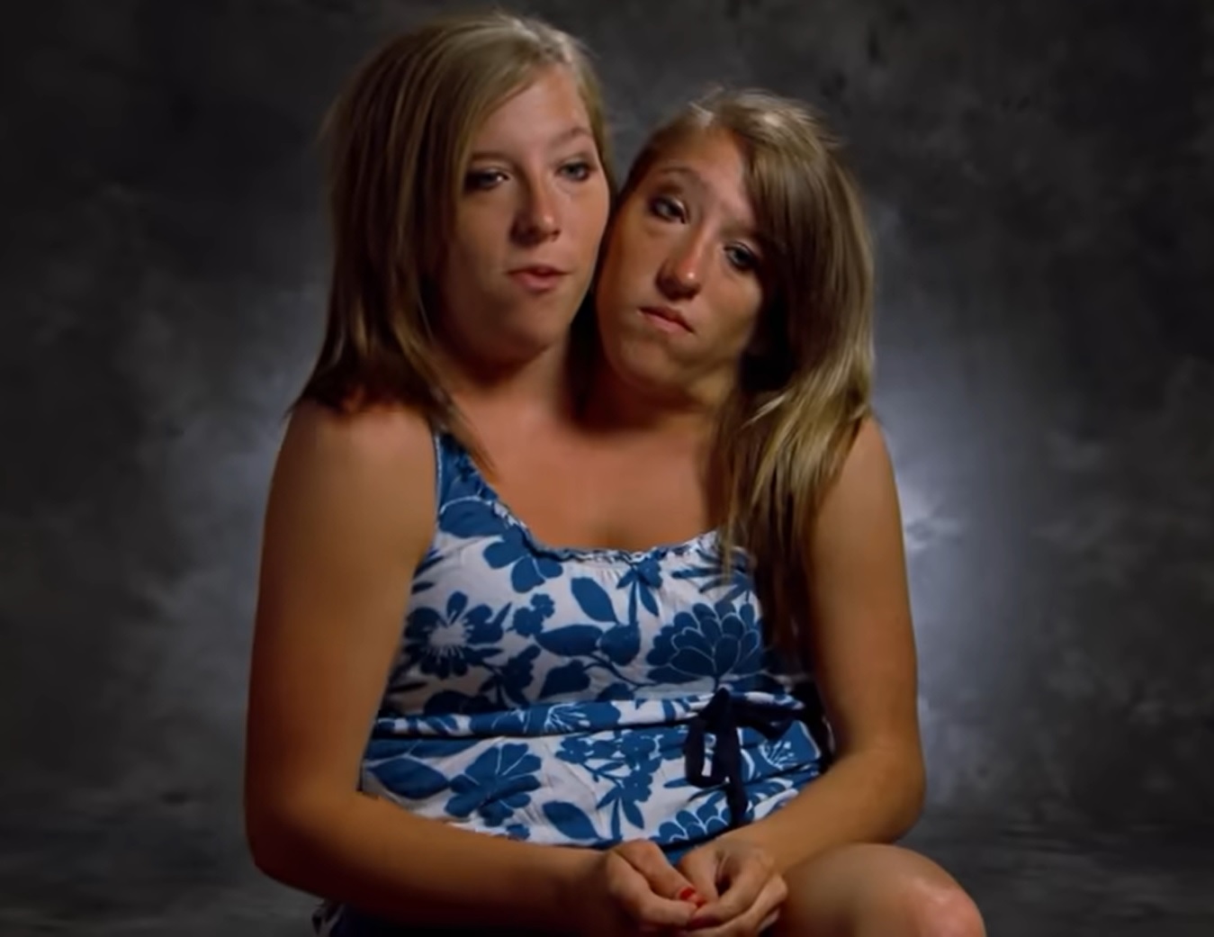 Watch: Twins Abigail and Brittany Hensel are 'One Body, Two Souls