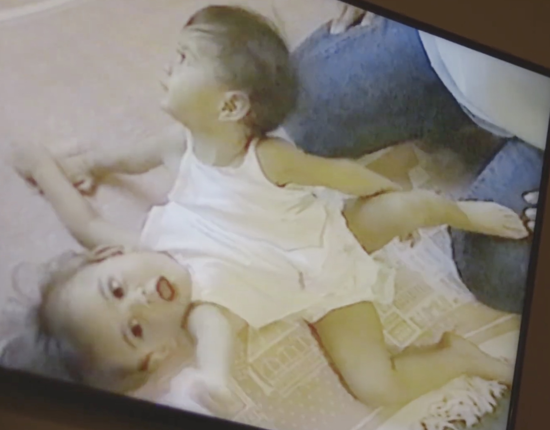 Conjoined twin reveals what happens when sister is intimate with her husband